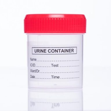 Wauzaji wa Urine Container Tanzania